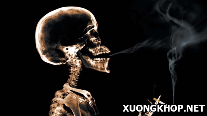 Bệnh vôi hóa cột sống có được hút thuốc lá không? 3