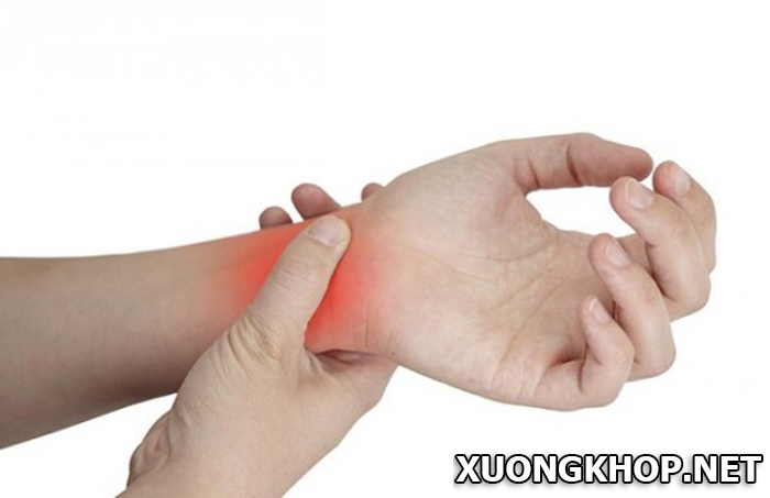 Viêm khớp cổ tay có nguyên nhân, triệu chứng và cách chữa trị như thế nào? 1