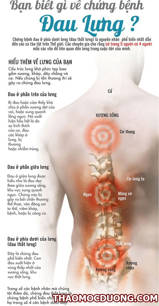 Mức độ nguy hiểm của đau lưng do chấn thương cột sống cách phòng bệnh 1
