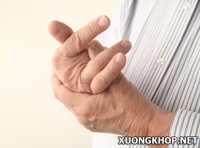 Thoái hóa khớp ngón tay, những dấu hiệu cơ bản nhận biết bệnh 2