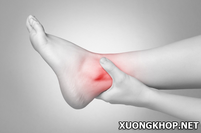 5 nguyên nhân cơ bản của bệnh viêm khớp cổ chân và bí kíp chữa bệnh hiệu quả 1