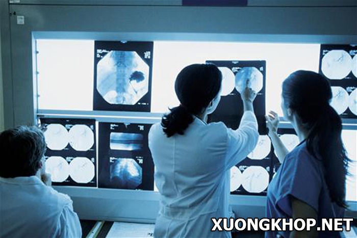 Hình ảnh X quang thoái hóa cột sống thắt lưng và một số tiêu chuẩn chẩn đoán 1