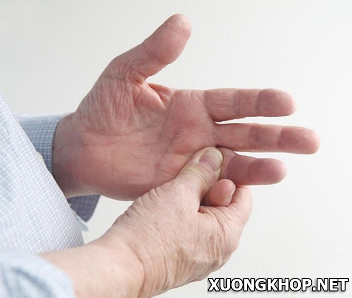 Một số nguyên nhân của bệnh viêm khớp ngón tay bạn cần biết 2