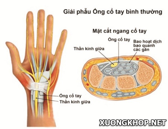 3 nguyên nhân gây viêm khớp cổ tay bạn không thể bỏ qua 1