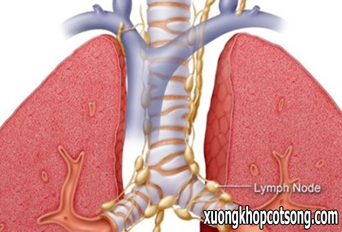 Bệnh lao phổi có lây không? Cách phòng tránh bệnh ra sao? 1