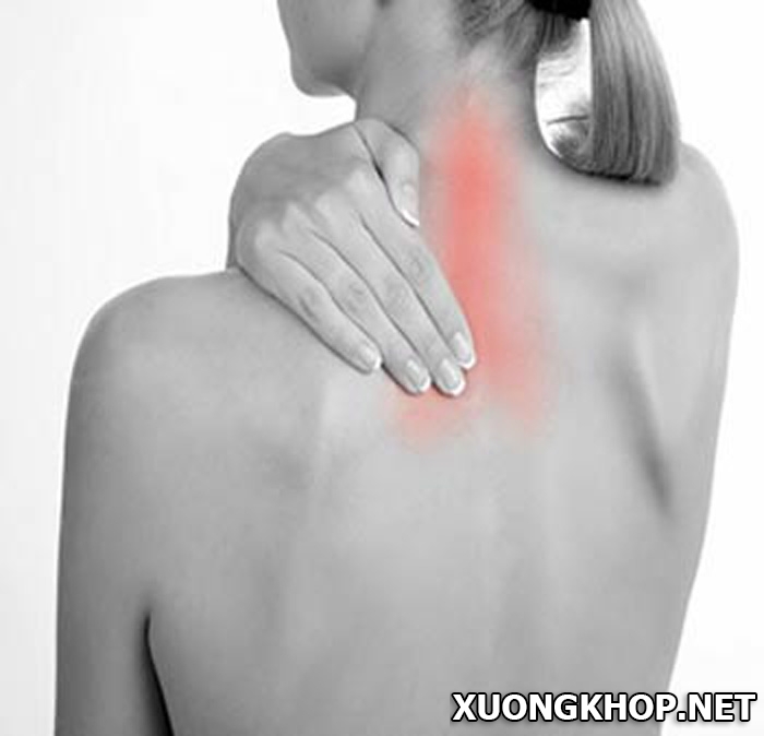 Bị đau lưng trên bên trái là bị bệnh gì? Nguyên nhân nào gây ra bệnh? 1
