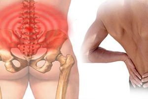 Đau lưng đau hông nguyên nhân là do đâu? Triệu chứng bệnh như thế nào?
