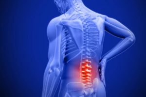 Triệu chứng đau thắt lưng là biểu hiện của bệnh gì?